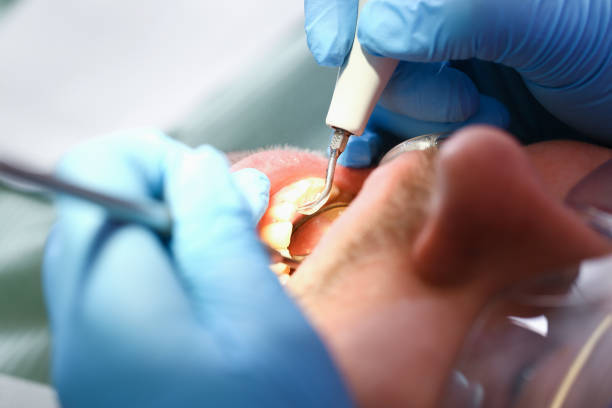 Best Pediatric Emergency Dentist in American Falls, ID